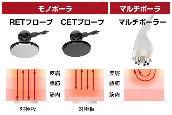 プローブの違い