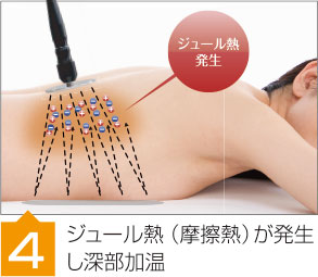 joule熱（摩擦熱）が発生し深部加温